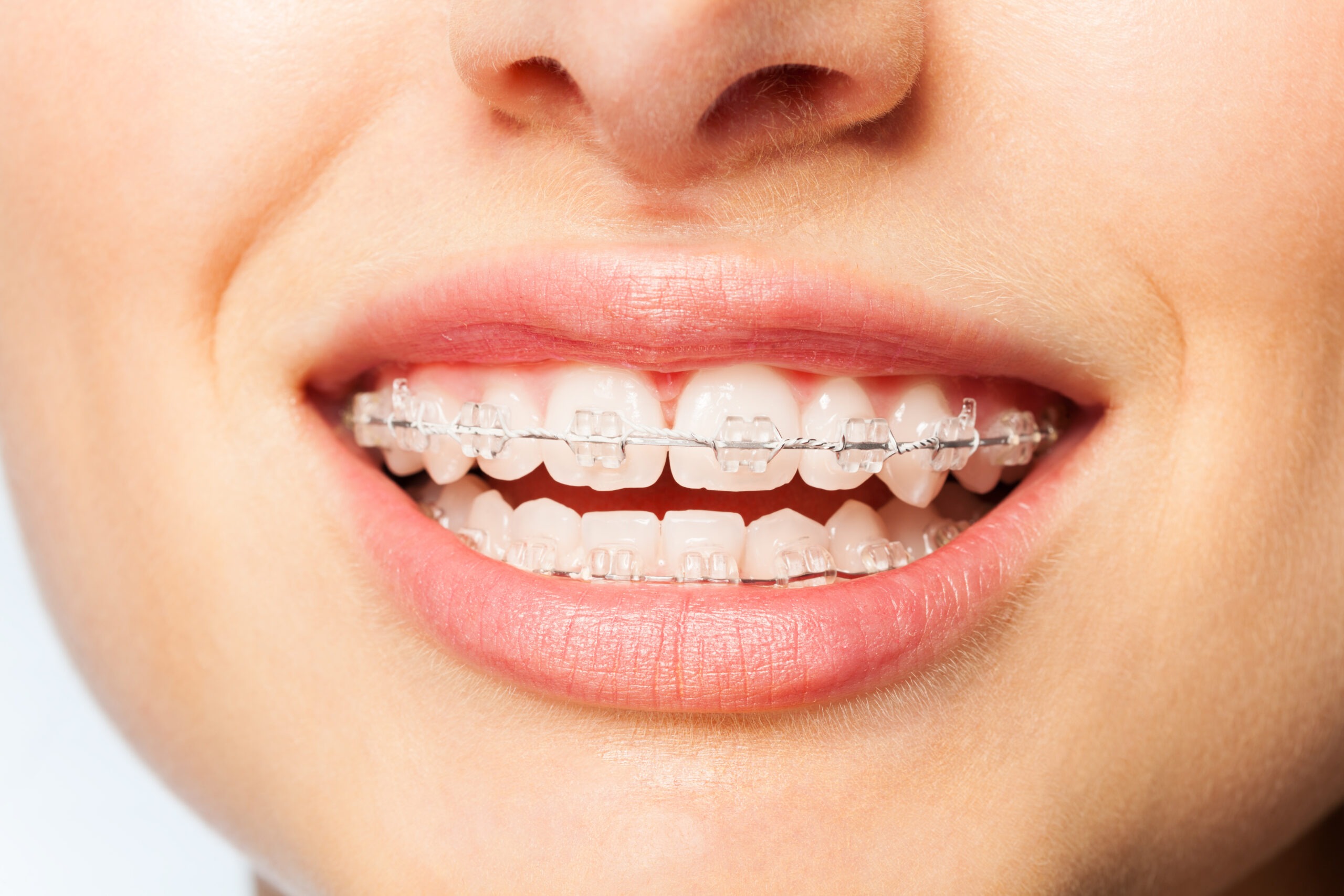 willowick orthodontics